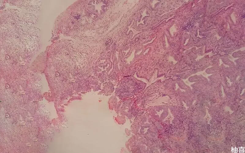 对宫颈细胞进行检查的图片