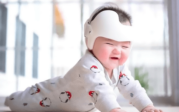 网红矫正婴儿头型的头盔或影响发育是真的吗?
