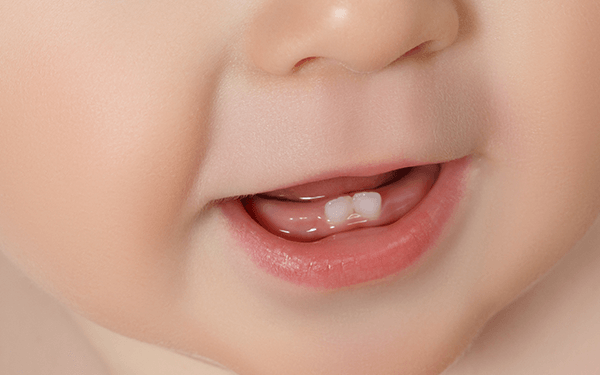婴儿出牙顺序是怎样的?先长上牙还是下牙?