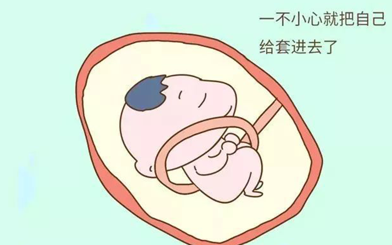 胎动频繁会导致脐带绕颈