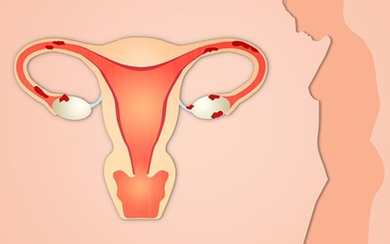 卵巢早衰可选择微刺激方案
