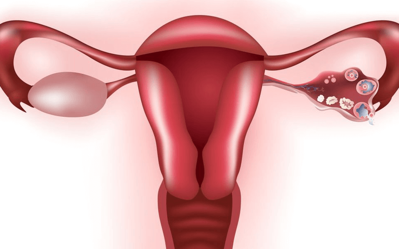 子宫内膜示意图