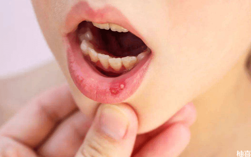 孕期舌头痛