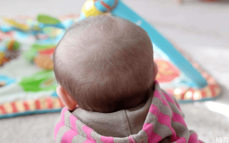婴儿满月的时候要剪头发
