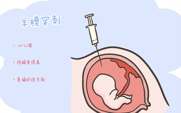 做完羊水穿刺术后睡觉用什么姿势好？可以侧躺吗？