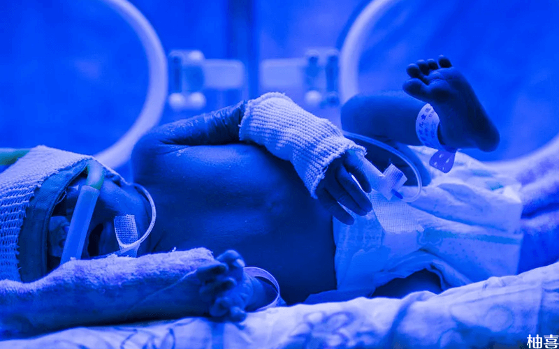 早产儿可以通过照蓝光治疗黄疸