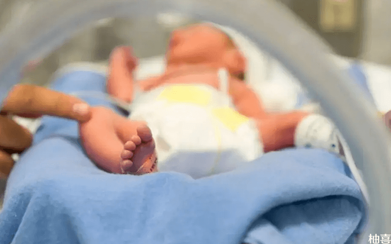 宝宝体质会影响黄疸持续时间