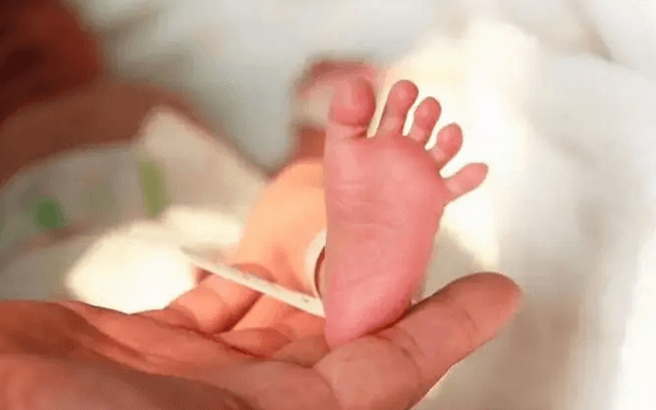 早产儿黄疸持续时间并不长，多久能退完由宝宝体质决定