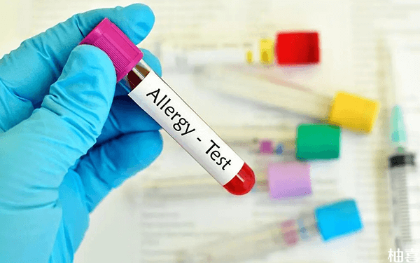 哪位宝妈带孩子查了过敏原，整个过程中宝宝受罪吗?
