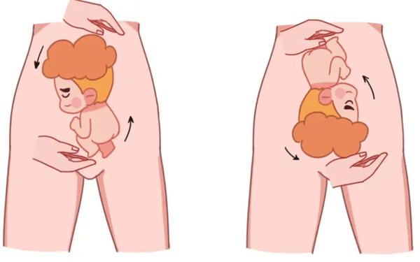 胎儿从臀位转头位是慢慢转还是突然转过去？
