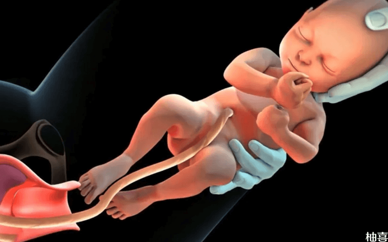 胎儿本身会导致胎儿窘迫