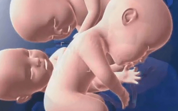 试管婴儿三胞胎不考虑减胎的话成活率高吗?
