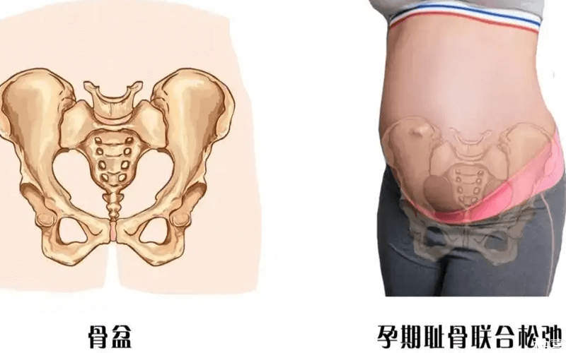 孕妇骨盆测量