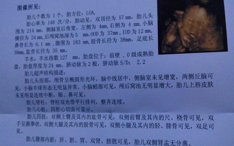 四维单子上蓝色并不是生男孩的表现