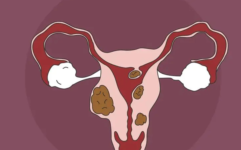 严重宫腔粘连会影响怀孕几率