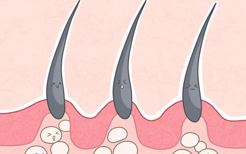 孕期受体内激素影响会出现长毛的情况