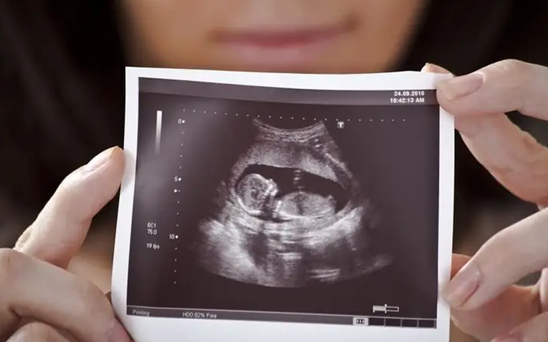 通过孕囊数据并不能看出宝宝的性别