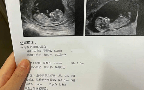 太原市中心医院生殖科郭晶晶做试管婴儿成功率高不高？