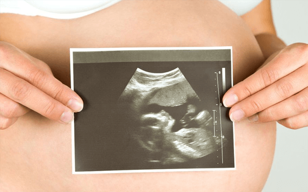 已生男宝的姐妹来验证下孕13周的NT单子长什么样？