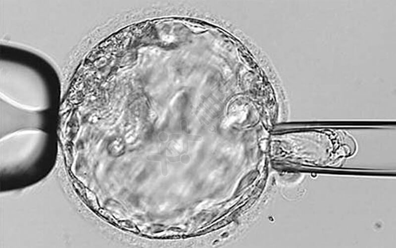 什么条件可以移植鲜胚